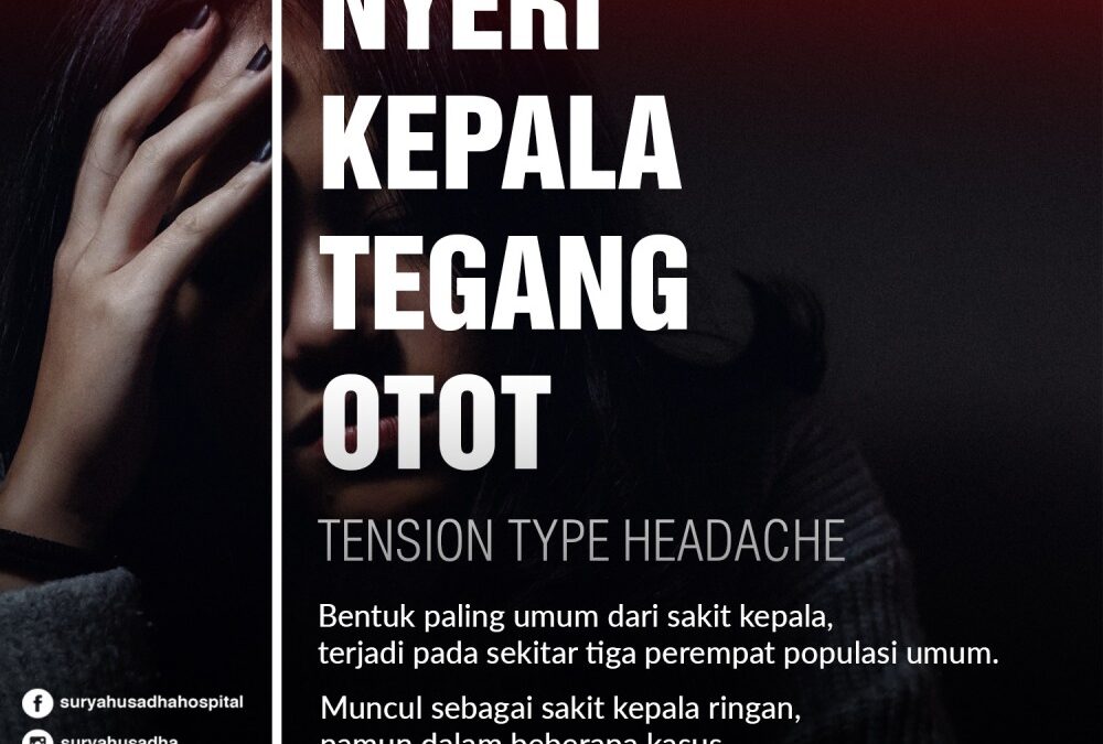 Sakit Kepala Tension Neck Syndrome: Penyebab, Pengobatan, dan Pencegahan