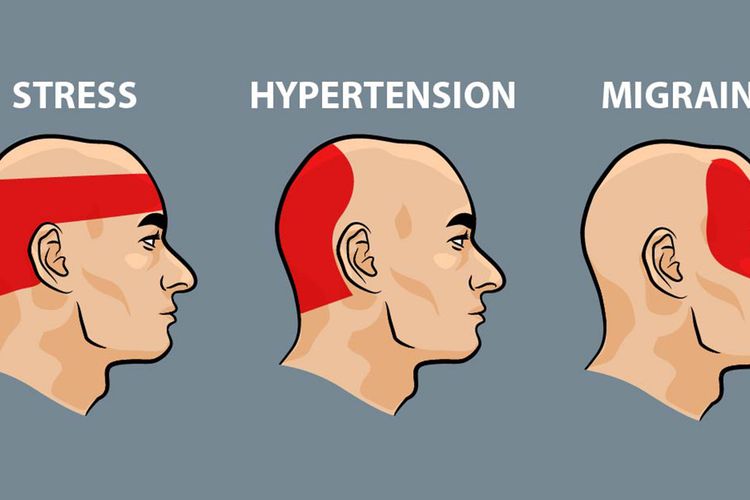 Mengatasi Sakit Kepala Bagian Belakang Akibat Gangguan Tidur dan Sleep Apnea Mengatasi Sakit Kepala Bagian Belakang Akibat Gangguan Tidur dan Sleep Apnea