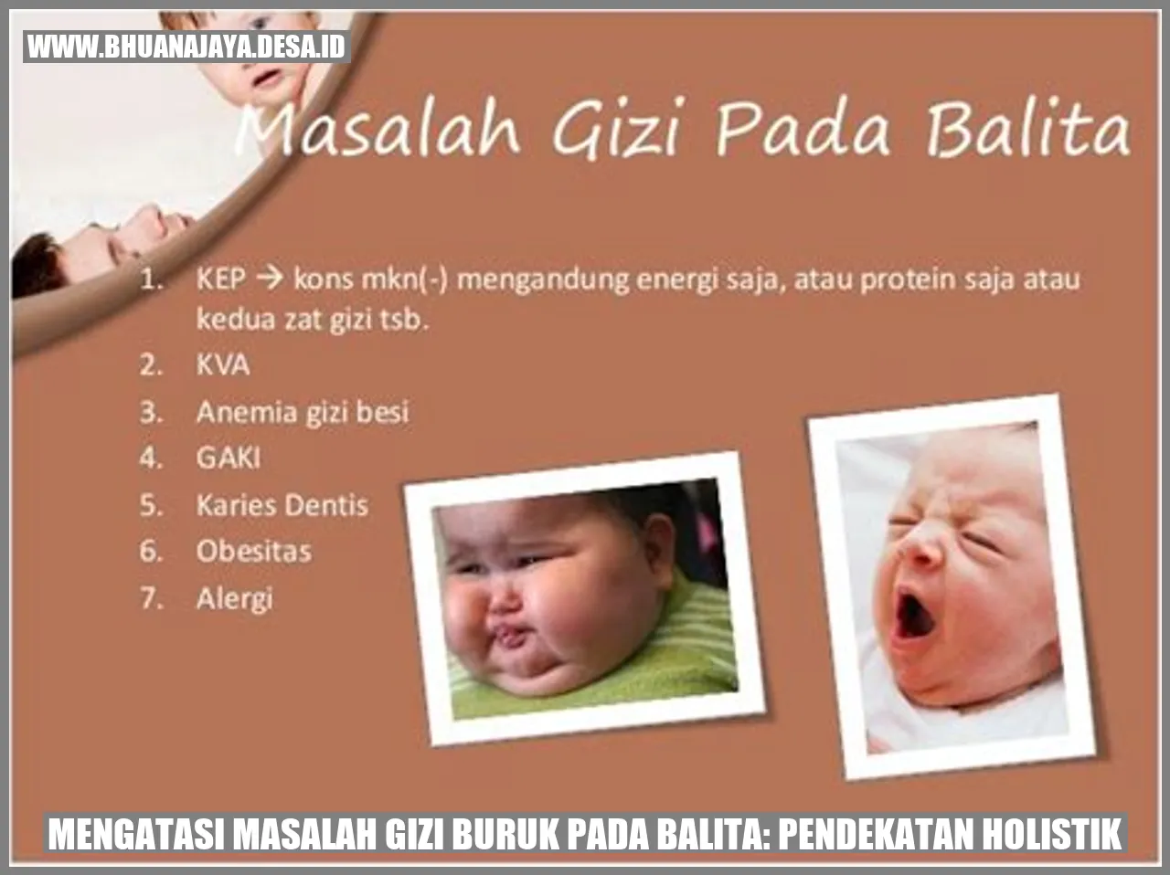 Mengatasi Masalah Gizi Buruk pada Balita: Pendekatan Holistik